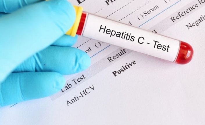 Hepatit C Belirtileri ve Uyarı İşaretleri